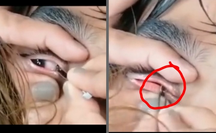 Viral Video Serangga Kecil Masuk Mata, Netizen Dibuat Geregetan Gara-gara Ini (foto/int)