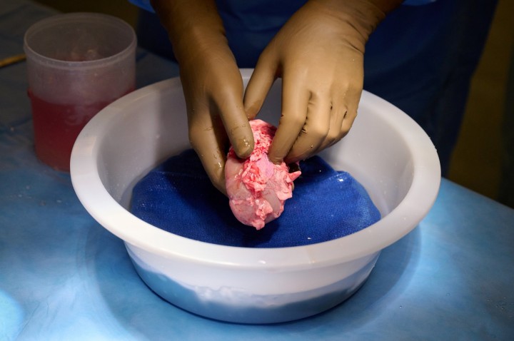 Ginjal babi hasil rekayasa genetika dibersihkan dan disiapkan untuk transplantasi ke manusia di NYU Langone di New York, AS (Foto Reuters)