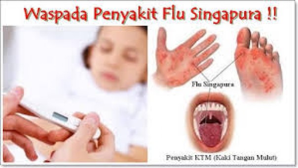 Waspadai Flu Singapura/int