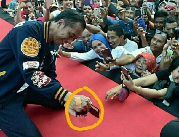Netizen bertanya-tanya tangan Jokowi diplester (foto/instagram) 