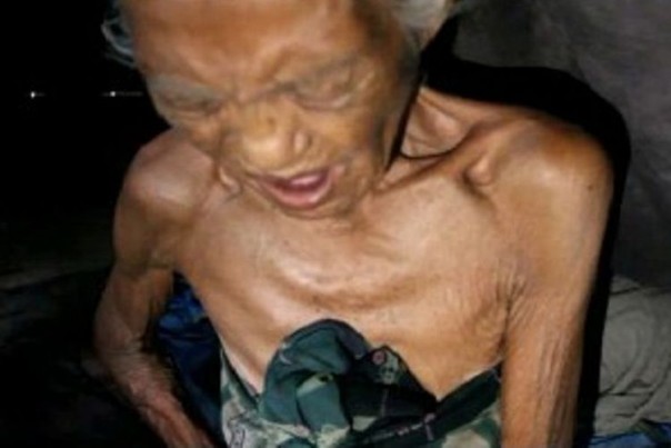 Sitti Muhda (95) yang mengalami sakit di ulut hati karena sudah berhari-hari tak makan. Foto: int 