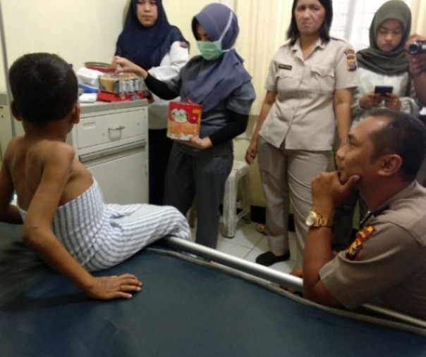Boy yang masih dirawat di RS Bhayangkara Polda Riau, setelah menjadi korban penganiayaan yang diduga dilakukan bapak angkatnya sendiri. Foto: hadi 