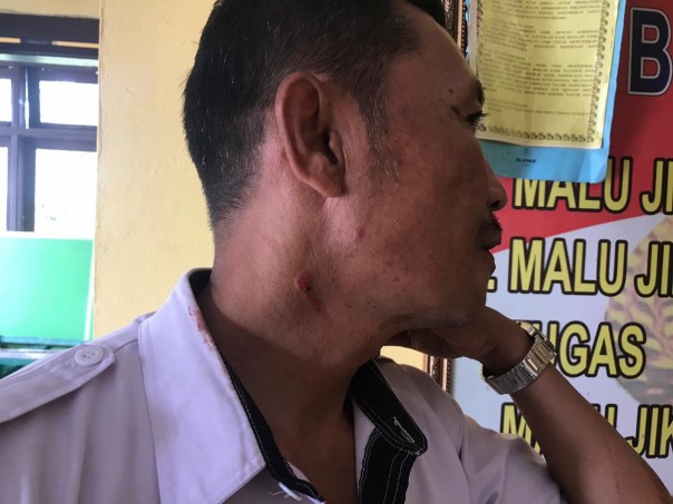  kepala sekolah Bambang Fajrianto (50) memperlihatkan lukas bekas cekikan di lehernya/azi