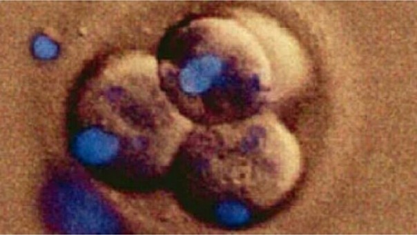 Embrio manusia hidup (foto/ilustrasi)