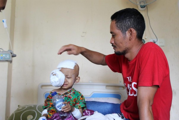 Putra Ramadhan (4) bocah kelahiran Sungai Piring, Kecamatan Batang Tuaka penderita kanker mata/rgo