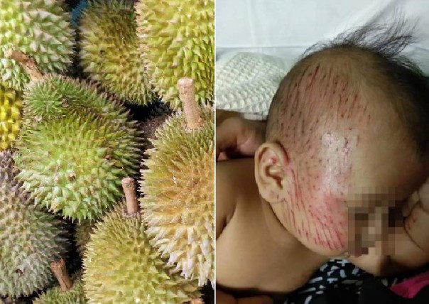 Seorang ibu dan putranya tertimpa durian jatuh yang berada di sekitar rumahnya (foto/int)