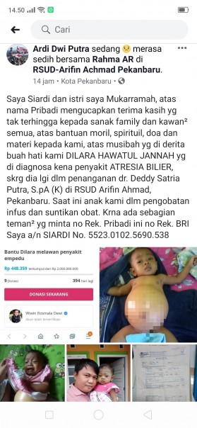 Dilara Hawatul Jannah, anak berusia setahun ini divonis dokter menderita Atresia Bilier./ardi