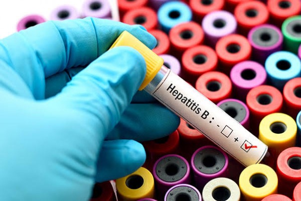 Banyak warga Kepulauan Meranti usia muda terjangkit Hepatitis B (foto/int)