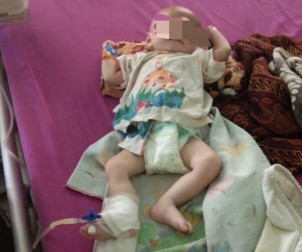 Seorang bayi dari Bunut, Pelalawan menderita gizi buruk (foto/Ardi)