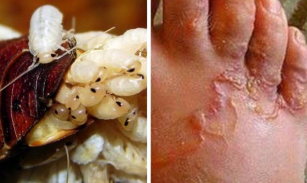Benarkah pijak kecoa berbahaya (foto/int)