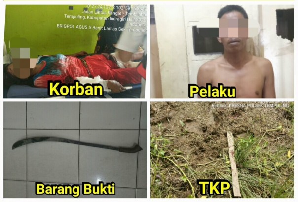 Saiyah (42) warga Kelurahan Sungai Salak, Kecamatan Tempuling, Kabupaten Indragiri Hilir (Inhil) Riau, menjadi korban penganiayaan suami sirinya dengan sebilah parang (foto/int)