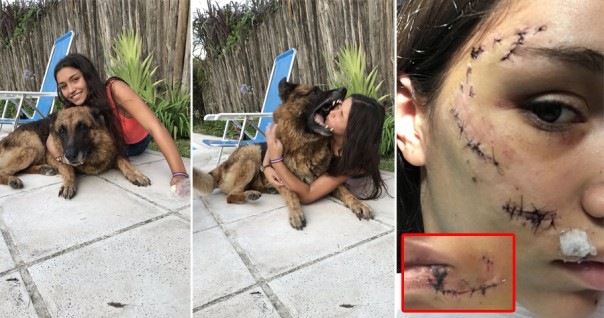 Wajah Gadis Cantik Ini Terpaksa Dijahit, Setelah Anjingnya Menyerang Saat Ia Berusaha Mengambil Swafoto