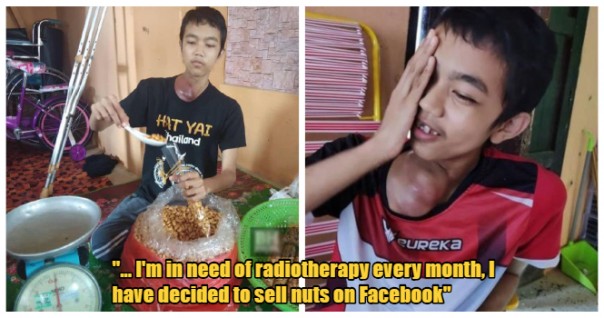 Kisah Bocah Pengidap Kanker yang  Menjual Kacang Lewat Media Sosial Jadi Viral di Malaysia