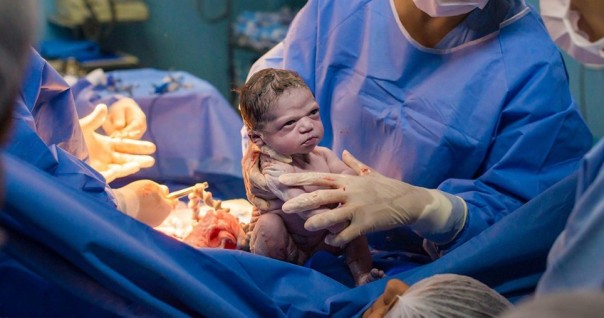Foto Bayi Dengan Tatapan Bengis Kepada Para Dokter Sesaat Setelah Dilahirkan Jadi Viral di Media Sosial