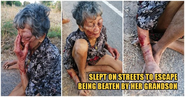 Tragis, Cucu Durhaka Ini Menganiaya Neneknya Hingga Terluka Parah,  Memaksanya Kabur Dari Rumah dan Tidur Di Jalanan