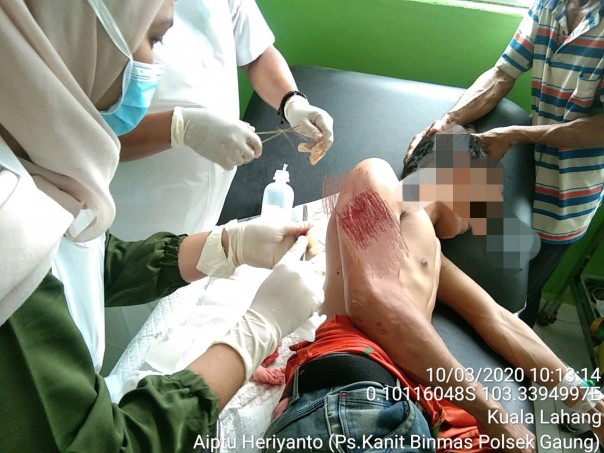 Yanto (27) seorang nelayan di Dusun Terusan Kempas, Kecamatan Gaung, Kabupaten Indragiri Hilir (Inhil) diterkam buaya di Parit Balil (foto/Rgo)