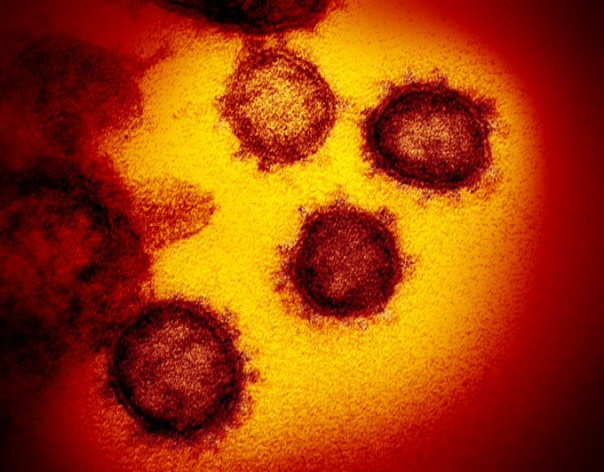 Penampakan Virus corona atau covid-19 (foto/int)