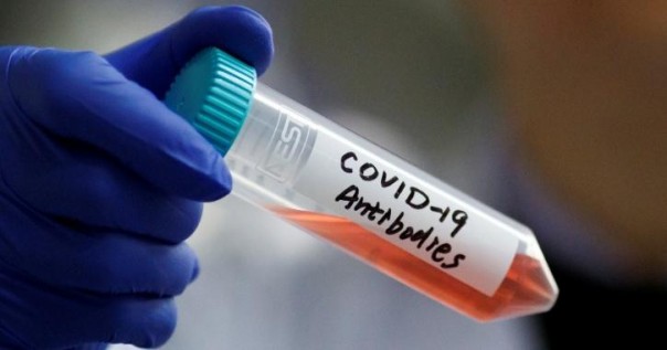 Sebuah Penelitian Terbaru Mengklaim Jika Obat Anti Parasitik Dapat Membunuh Coronavirus Hanya Dalam 48 Jam
