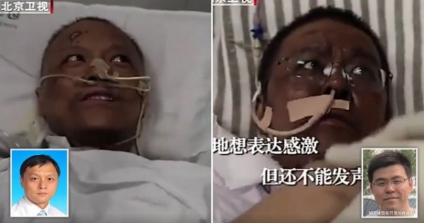 Tragis, Kulit Para Dokter Wuhan yang Sembuh Dari Virus Corona Berubah Warna, Ini Penyebabnya...