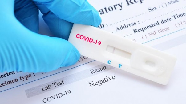 Seekor kambing dan satu buah pepaya dinyatakan positif mengidap virus covid-19 di Tanzania (foto/int)