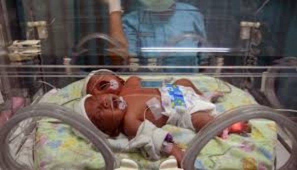 Kasihan, Bayi Kembar Asal Gujarat yang Baru Berusia Enam Hari Ini Jadi Pasien Covid-19 Termuda di India
