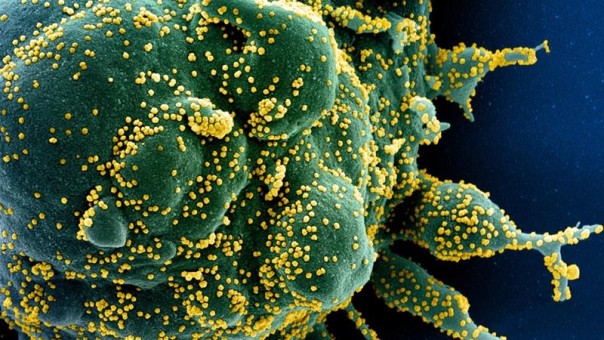 Cambridge Memulai Uji Coba Vaksin Virus Corona, Sementara Sudah Ada 30 Vaksin yang Diuji Coba Pada Manusia