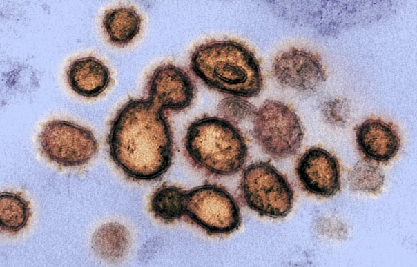 Penelitian di Houston Menunjukkan Inilah Struktur Virus Korona yang Paling Menular dan Mendominasi