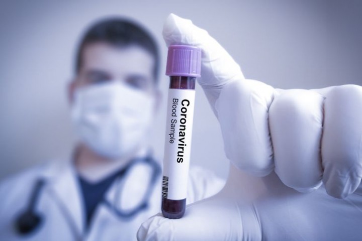 Bank Dunia Kembali Kucurkan Dana Hingga USD 12 Miliar Untuk Mendanai Vaksin Virus Corona