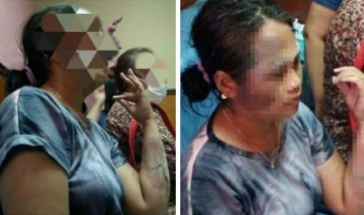 Suami Siram Istri Pakai Air Panas Lantaran Kesal Suka Main TikTok, Netizen Sebut Begini (foto/int)