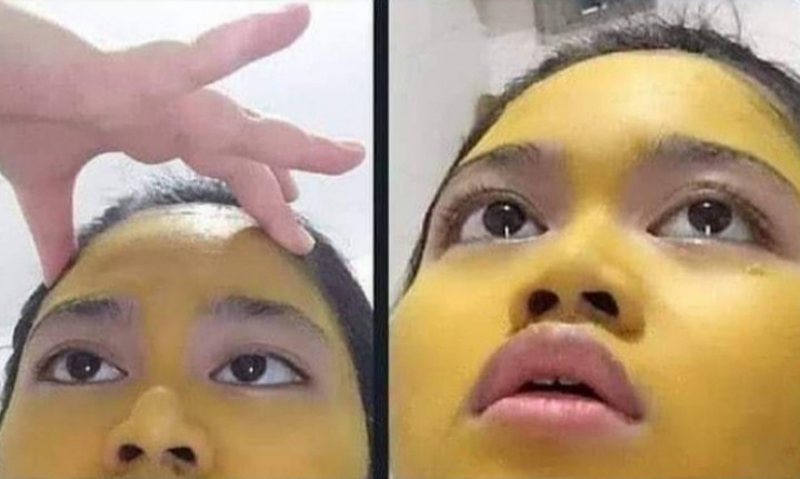 Niat Hati Biar Tampil Glowing, Wanita Ini Curhat Kuning di Mukanya Enggak Hilang-hilang, Karena Maskeran Pakai Kunyit (foto/int)
