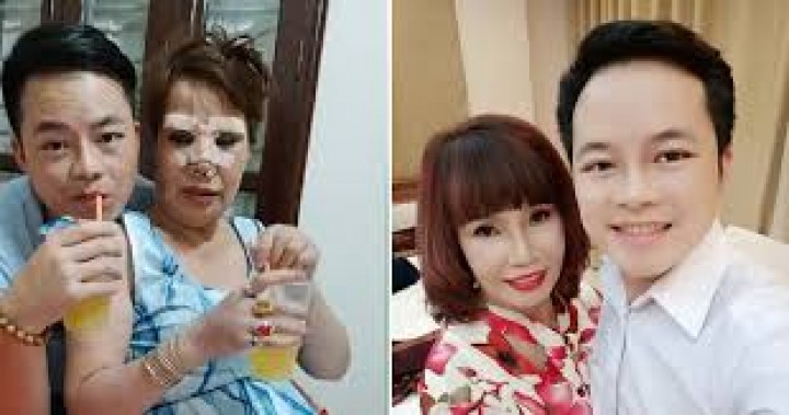 Wanita Vietnam Berusia 62 Tahun Ini Menikah Dengan Pria Muda, Nekat Lakukan Hal Gila ini Agar Selalu Tampil Cantik