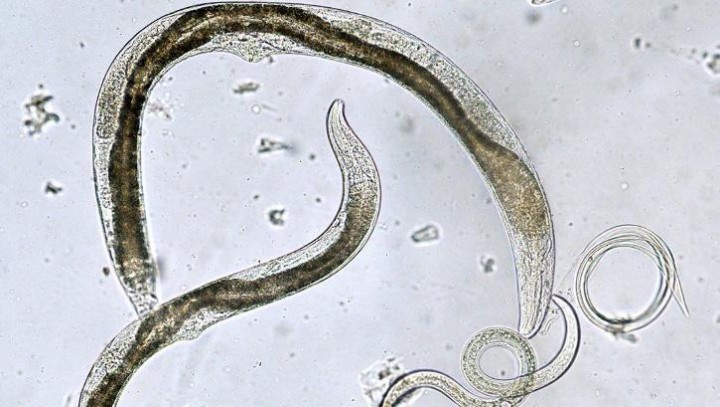 Menjijikkan, Hasil Ultrasonografi Pria Ini Menunjukkan Cacing Gelang Parasit Menggeliat di Dalam Perutnya