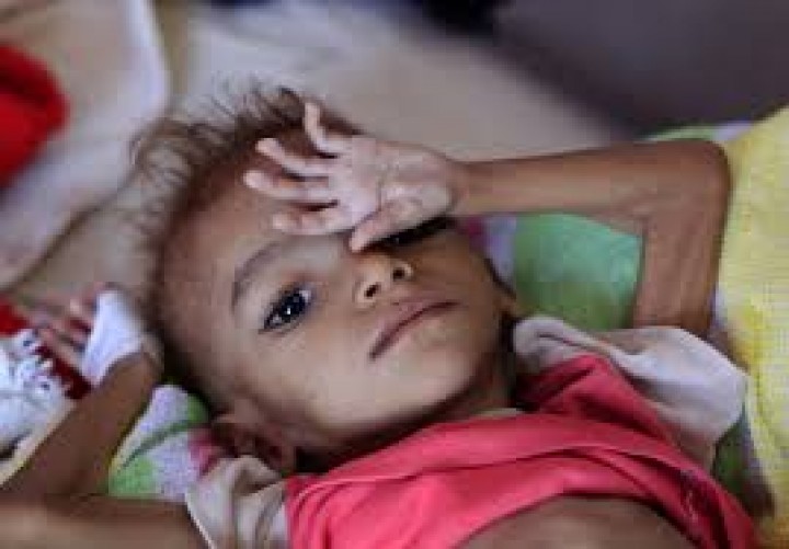 PBB Minta Dunia Untuk Menyelamatkan Jutaan Warga Yaman Dari Bencana Kelaparan