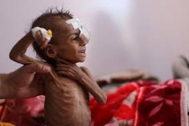 IRC Ungkap Yaman Menjadi Negara Paling Berisiko Mengalami Bencana Kemanusiaan Pada Tahun 2021