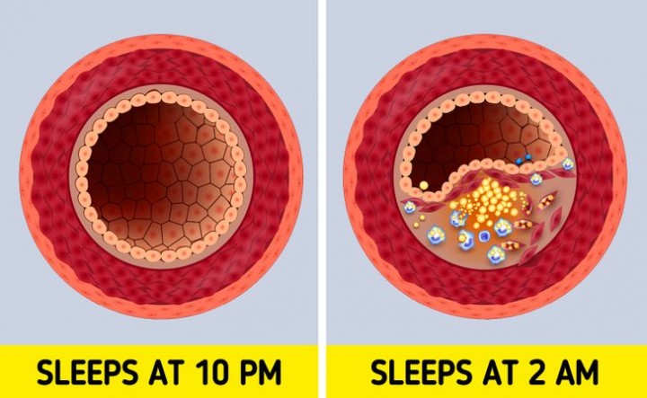 Ladies, Inilah yang Akan Terjadi JIkaAnda Tidur Pada Jam 10 Malam  (foto : deposit)