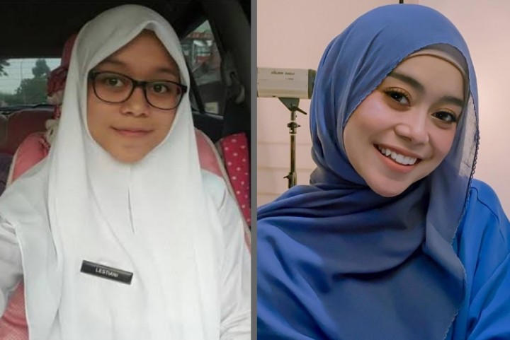 Potret Cantik Lesti Kejora Dulu Dengan Sekarang, Netizen Bilang Begini (foto/int)