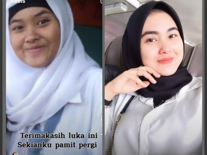 Cewek Cantik Ini Bandingkan Foto Jadul dengan Sekarang, Netizen: Glow Up Bikin Insecure (foto/int)