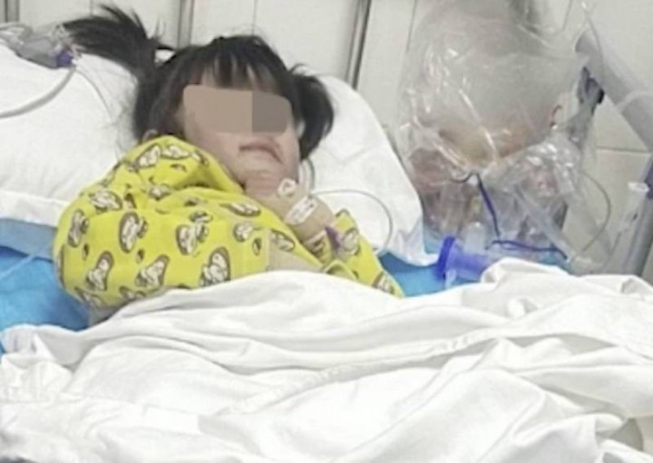 Tragis, Bocah Asal China Ini Dibakar Dengan Cairan Panas Oleh Pacar Ayahnya, Begini Kondisinya Saat Ditemukan