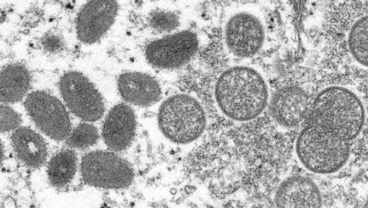 Gambar mikroskop elektron 2003 yang disediakan oleh Centers for Disease Control and Prevention ini menunjukkan virion monkeypox dewasa berbentuk oval, kiri, dan virion imatur bulat, kanan, yang diperoleh dari sampel kulit manusia yang terkait dengan wabah anjing padang rumput 2003.