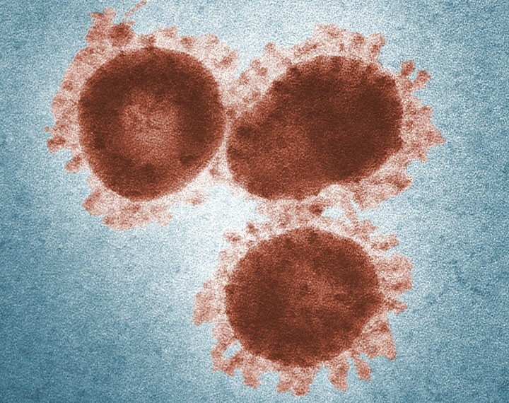 Ilustrasi virus monkeypox atau cacar monyet (CDC/Pexels)