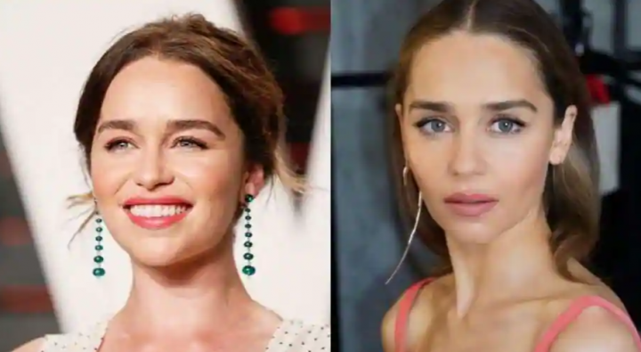 Emilia Clark pemeran film Game of Thrones sebut dirinya kehilangan sedikit bagian otaknya setelah operasi Aneurisma /instagram