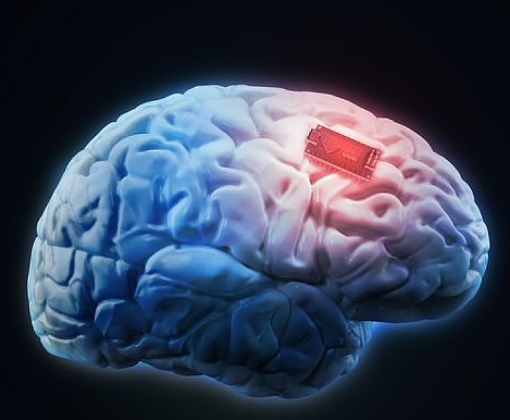 Ilmuwan usulkan penanaman chip di dalam otak pelaku kejahatan untuk mengurangi angka kriminal di masyarakat /Shutterstock