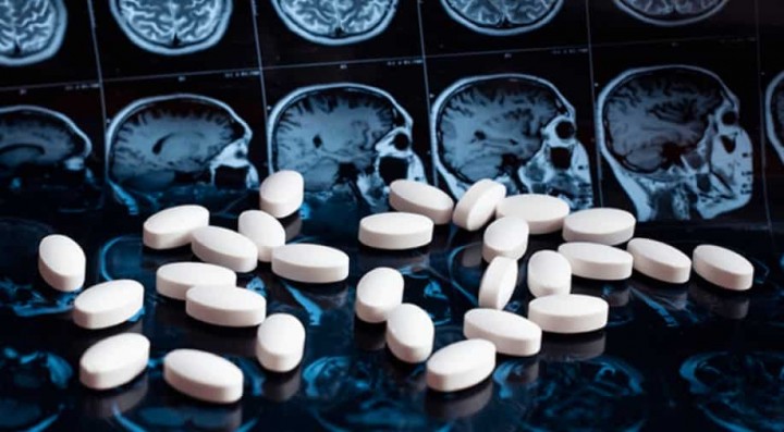 Terobosan Medis temukan obat Alzheimer eksperimental memperlambat penurunan kognitif sebesar 27 persen /AFP