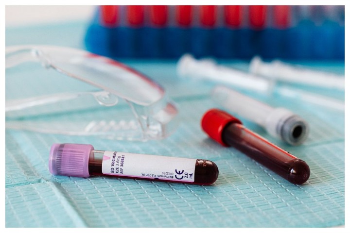 Golongan Darah Baru Teridentifikasi Yang Menimbulkan Ancaman Serius Bagi Bayi Pada Wanita Hamil