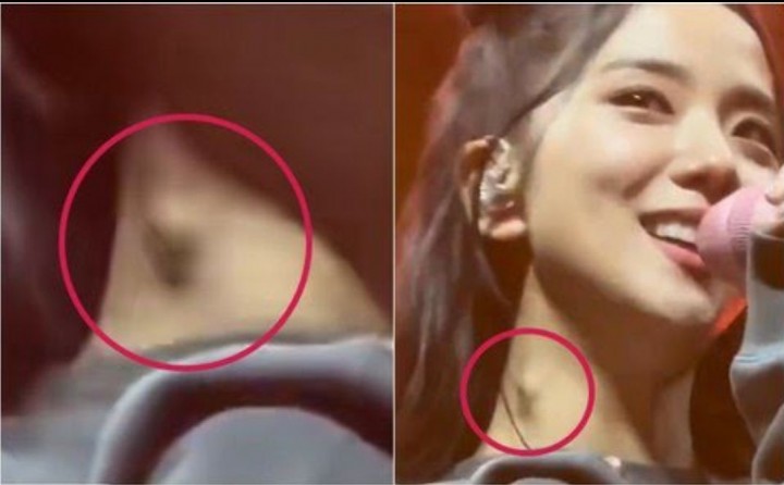 Potret Leher Jisoo BLACKPINK yang Terlihat Memiliki Benjolan yan Cukuo Besar di Area Lehernya. (Twitter)