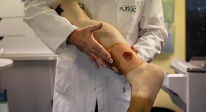 Perusahaan medis Prancis bersiap akan membuat kulit buatan untuk korban luka bakar /AFP