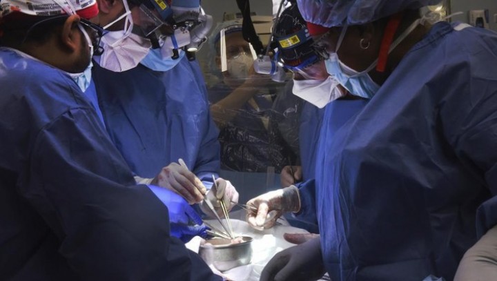 Tim Dokter AS Kembali Cangkok Jantung Babi ke Manusia, Begini Kondisi Pasien