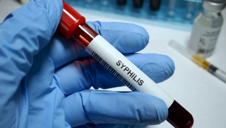 CDC Laporkan Kasus Sifilis pada Bayi Baru Lahir di AS Melonjak 10 Kali Lipat  