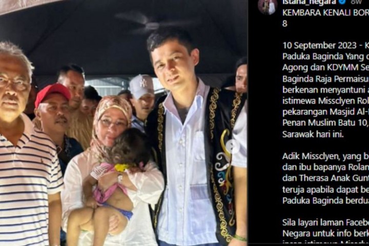 Bocah 2 Tahun Asal Malaysia Idap Sindrom 'Manusia Serigala', Ini Penjelasannya. (Kompas.com/Foto)