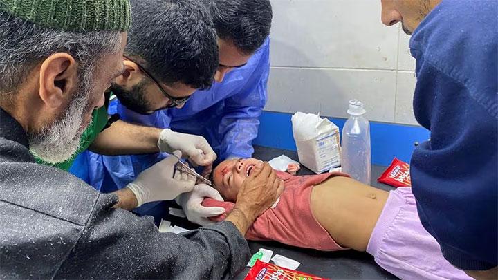 Kisah Pilu Gaza: RS Kehabisan Anestesi, Pasien Berjuang Lawan Rasa Sakit dengan Al-Quran. (X/Foto)